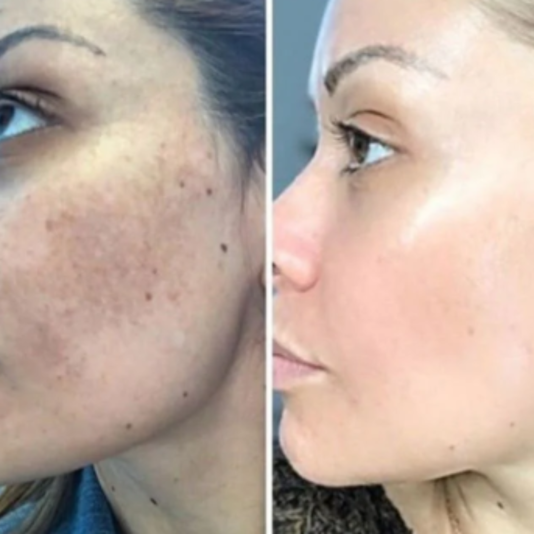 Nk Serum+ | Efecto Anti-Edad y Luminosidad Instantánea